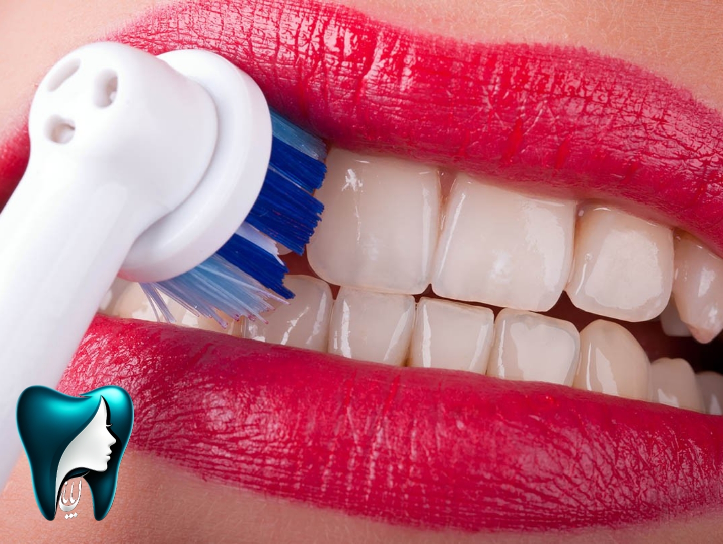 عکس جرم‌گیری و بروساژ